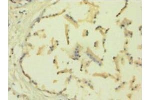 Immunohistochemistry of paraffin-embedded human plastate using TIMP1 Antibody at a dilution of 1:100.