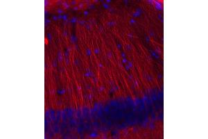 Immunohistochemistry (IHC) image for anti-Tubulin, beta 3 (TUBB3) (AA 443-450) antibody (ABIN1742554) (TUBB3 antibody  (AA 443-450))