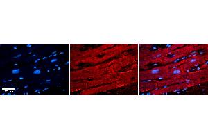 Rabbit Anti-ID1 Antibody   Formalin Fixed Paraffin Embedded Tissue: Human heart Tissue Observed Staining: Cytoplasmic Primary Antibody Concentration: N/A Other Working Concentrations: 1:600 Secondary Antibody: Donkey anti-Rabbit-Cy3 Secondary Antibody Concentration: 1:200 Magnification: 20X Exposure Time: 0.