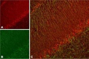 Expression of KV11. (KCNH7 antibody  (Intracellular))