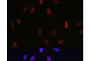 Immunofluorescence analysis of U-2 OS cells using MonoMethyl-Histone H3-K14 Polyclonal Antibody at dilution of 1:100 (40x lens). (Histone 3 antibody  (meLys14))