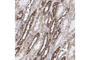 Immunohistochemical staining (Formalin-fixed paraffin-embedded sections) of human kidney shows strong cytoplasmic positivity in distal tubules. (MAD2L1 antibody)
