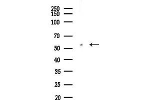 anti-Nicotinate phosphoribosyltransferase (NAPRT) (Internal Region) antibody