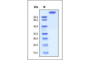 SDS-PAGE (SDS) image for Leukemia Inhibitory Factor Receptor alpha (LIFR) (AA 45-833) (Active) protein (Fc Tag) (ABIN2444162) (LIFR Protein (AA 45-833) (Fc Tag))