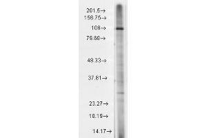 Western Blot analysis of Rat brain membrane lysate showing detection of TrpC7 protein using Mouse Anti-TrpC7 Monoclonal Antibody, Clone S64A-36 . (TRPC7 antibody  (AA 845-862) (HRP))