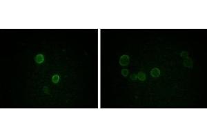 Immunofluorescence analysis of methanol-fixed L-02 (left) and Cos7 (right) cells using ApoM mouse mAb showing cytoplasmic and membrane localization. (Apolipoprotein M antibody)