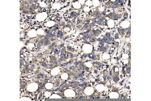 IHC analysis of QSOX2 using anti-QSOX2 antibody (ABIN7599640). (QSOX2 antibody  (AA 102-523))