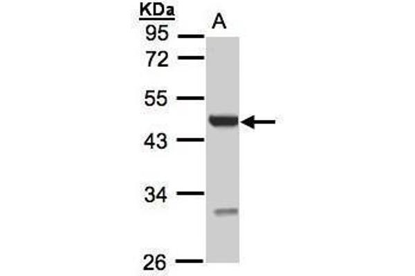 UST antibody