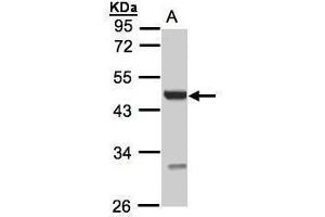 WB Image Sample(30 ug whole cell lysate) A:293T 10% SDS PAGE antibody diluted at 1:1000 (UST antibody)