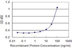 Detection limit for recombinant GST tagged ATP8B1 is 1 ng/ml as a capture antibody. (ATP8B1 antibody  (AA 471-551))