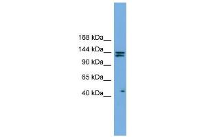 IARS antibody used at 1 ug/ml to detect target protein. (IARS antibody  (Middle Region))