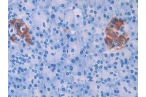 DAB staining on IHC-P; Samples: Human Pancreas Tissue (HPSE antibody  (AA 54-278))
