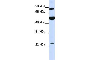Western Blotting (WB) image for anti-Mannosyl-Oligosaccharide Glucosidase (MOGS) antibody (ABIN2459038) (GCS1 antibody)