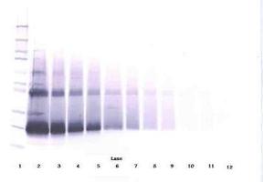 Image no. 3 for anti-Interferon, beta 1, Fibroblast (IFNB1) antibody (ABIN464941) (IFNB1 antibody)