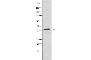 Western blot analysis of extracts from Jurkat cells, using RAD51L3 antibody. (RAD51D antibody  (C-Term))