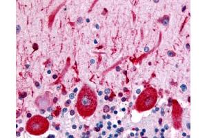 Anti-CELSR3 antibody IHC of human brain, Purkinje neurons. (CELSR3 antibody  (N-Term))