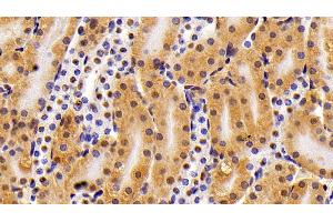Immunohistochemistry (IHC) image for anti-High Mobility Group Box 1 (HMGB1) (AA 1-215) antibody (ABIN7431743)