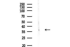 Western blot analysis of lysates from Rat testis, using TNN Antibody at 1/1000 dilution.
