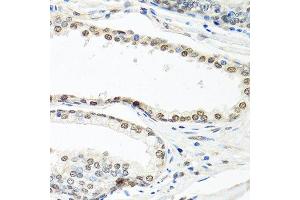 Immunohistochemistry (Paraffin-embedded Sections) (IHC (p)) image for anti-ELAV (Embryonic Lethal, Abnormal Vision, Drosophila)-Like 1 (Hu Antigen R) (ELAVL1) (AA 1-100) antibody (ABIN6140112)