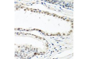 Immunohistochemistry of paraffin-embedded human prostate using ELAVL1 antibody. (ELAVL1 antibody  (AA 1-100))