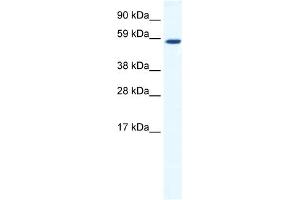 WB Suggested Anti-TAF1B Antibody Titration:  1. (TAF1B antibody  (C-Term))
