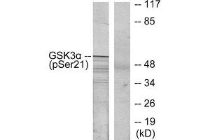 Western Blotting (WB) image for anti-Glycogen Synthase Kinase 3 alpha (GSK3a) (pSer21) antibody (ABIN1847476) (GSK3 alpha antibody  (pSer21))