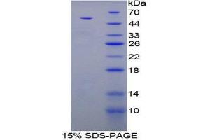 SDS-PAGE (SDS) image for Parathyroid Hormone (PTH) (AA 32-115) protein (His tag,MBP tag) (ABIN2123792)