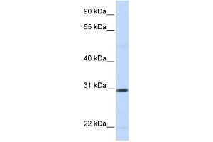 WB Suggested Anti-STC1 Antibody Titration:  0. (Stanniocalcin 1 antibody  (N-Term))