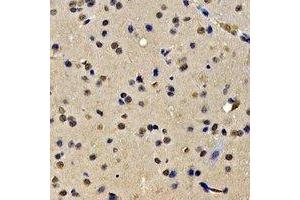 Immunohistochemical analysis of SKIV2L2 staining in rat brain formalin fixed paraffin embedded tissue section.