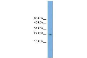 Human COLO205; WB Suggested Anti-PPIL3 Antibody Titration: 0. (PPIL3 antibody  (Middle Region))