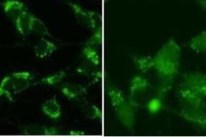 SY5Y cells were pretreated with 5nM bafilomycin for 24hr and fixed in methanol (left panel) or 4 % of paraformaldehyde (right panel). (LC3B antibody  (cleaved))