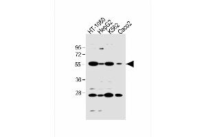 All lanes : Anti-SLC10A1 Antibody (C-term) at 1:1000 dilution Lane 1: HT-1080 whole cell lysate Lane 2: HepG2 whole cell lysate Lane 3: K562 whole cell lysate Lane 4: Caco2 whole cell lysate Lysates/proteins at 20 μg per lane. (SLC10A1 antibody  (AA 316-343))
