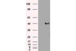 Image no. 16 for anti-Myc Proto-Oncogene protein (MYC) antibody (ABIN1497011) (c-MYC antibody)