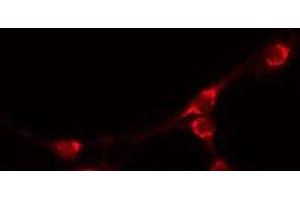 ABIN6277470 staining COLO205 by IF/ICC.
