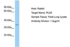 Image no. 1 for anti-Phospholipase D Family, Member 5 (PLD5) (AA 189-238) antibody (ABIN6750223)