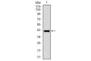 Image no. 4 for anti-E2F Transcription Factor 1 (E2F1) antibody (ABIN1491636) (E2F1 antibody)