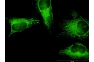 Immunofluorescence of monoclonal antibody to GSDMB on HeLa cell. (Gasdermin B antibody  (AA 1-411))