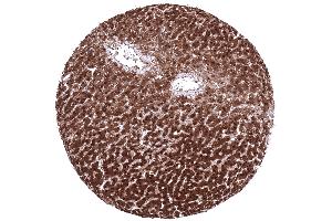 Strong nuclear and cytoplasmic arginase 1 expression in all hepatocytes in a normal liver (Recombinant Liver Arginase antibody  (AA 300-400))