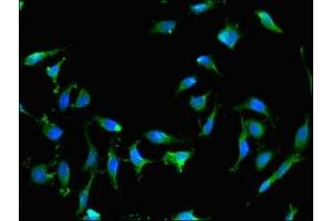 Immunofluorescent analysis of Hela cells using ABIN7167262 at dilution of 1:100 and Alexa Fluor 488-congugated AffiniPure Goat Anti-Rabbit IgG(H+L) (RAB25 antibody  (AA 1-210))