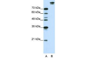 WB Suggested Anti-SF3B1 Antibody Titration:  0. (SF3B1 antibody  (N-Term))