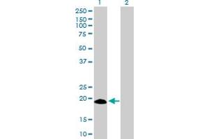 Western Blot analysis of IFNA17 expression in transfected 293T cell line by IFNA17 MaxPab polyclonal antibody.