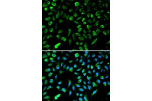 Immunofluorescence analysis of A549 cell using NME1 antibody.