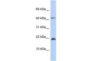 Western Blotting (WB) image for anti-SFRS12-Interacting Protein 1 (SFRS12IP1) antibody (ABIN2463941)