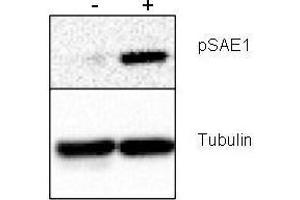 Western blot using  Rabbit anti-SAE1 pS185 antibody shows detection of phosphorylated SAE1. (SAE1 antibody  (pSer185))