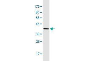 Western Blot detection against Immunogen (36. (DICER1 antibody  (AA 1813-1912))