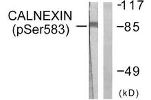 Western blot analysis of extracts from HeLa cells treated with EGF 200ng/ml 30', using Calnexin (Phospho-Ser583) Antibody.