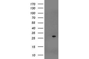 HEK293T cells were transfected with the pCMV6-ENTRY control (Left lane) or pCMV6-ENTRY SOCS3 (Right lane) cDNA for 48 hrs and lysed. (SOCS3 antibody)