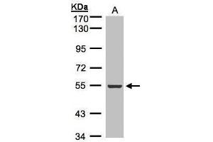 WB Image Sample(30 μg of whole cell lysate) A:A431, 7. (ILK antibody)