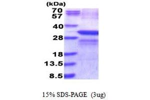 SDS-PAGE (SDS) image for Lysyl Oxidase (LOX) (AA 169-417) protein (His tag) (ABIN5853903)