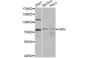Western blot analysis of extracts of various cell lines, using GRN antibody (ABIN6292502) at 1:1000 dilution.